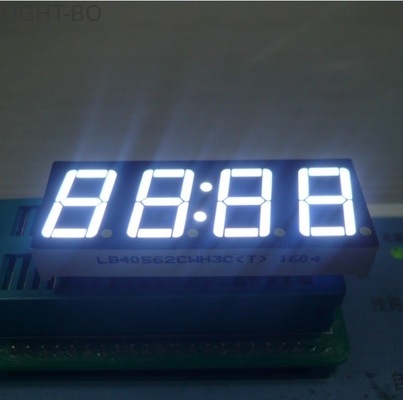 Exhibición para el contador de tiempo del horno de microondas, exhibición del reloj del LED del reloj de Digitaces